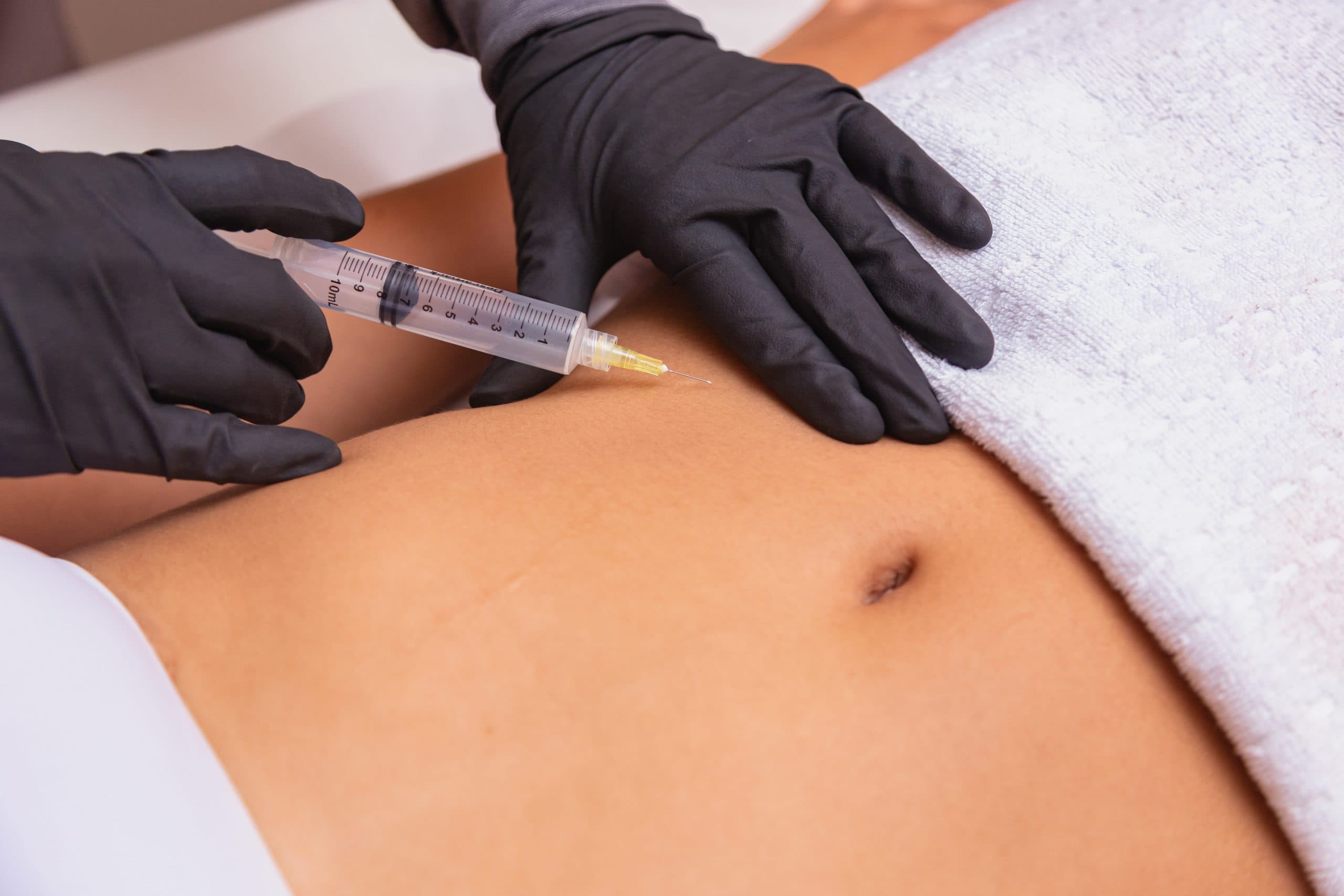 Black-gloved clinician performing abdominal injection
